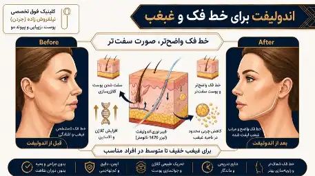 اندولیفت