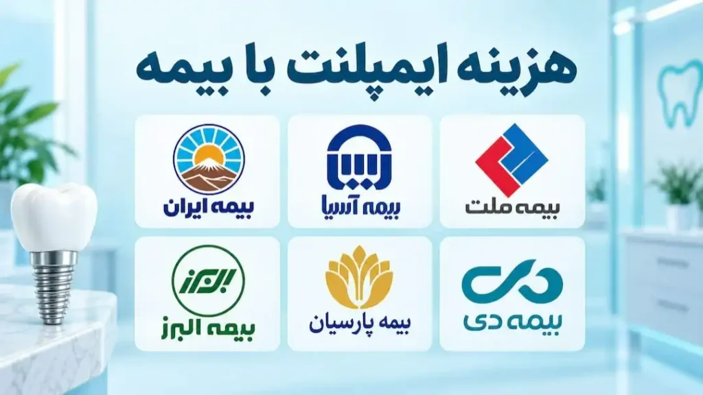 هزینه ایمپلنت دندان با بیمه تکمیلی در سال 1405 + شرایط